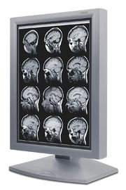 명확한 그림 의학 급료 전시, 5MP 회색 가늠자 의학 전시