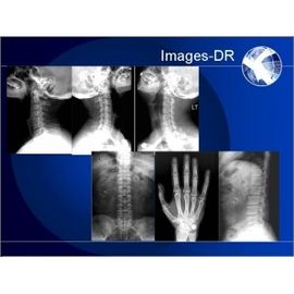가동 가능한 UC 팔을 가진 Mammogrpahy 엑스레이 디지털 방식으로 방사선 사진술 기계