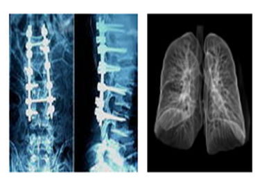 예리한 방사선 사진 의학 엑스레이 영화, Ct Digital Dry Imaging Mri 박사 영화
