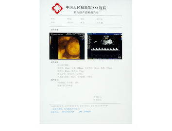 KND-DRYTEC-3000, KND-DRYTEC-4000를 위한 찰상 저항하는 엑스레이 종이 의학 영화