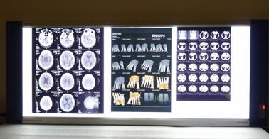 밝은 의학 엑스레이 건조한 열 인쇄 기계 영화 레이저 파랑 기초