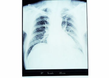 AGFA/FUJI 2000년을 위한 건조한 엑스레이 의학 진단 화상 진찰 방사선학