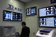 Good price 투명도 디지털 방식으로 엑스레이 영화, 의학 화상 진찰 AGFA/Fuji 엑스레이 건조한 영화 온라인으로