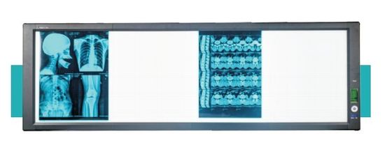 좋은 가격 LED 의료 초 밝은 뷰어 박스 온라인으로