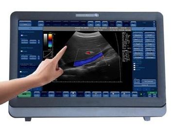 Good price 15 인치 LED 감시자를 가진 의학 3D/4D 색깔 도풀러 초음파 체계 휴대용 온라인으로
