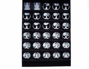의학 엑스레이 영화, CT/DR/MRI를 위한 열 인쇄 기계와 호환이 되는 건조한 화상 진찰 영화