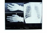 10 x 14inch는 Fuji 3000/2000년/1000년을 위한 의학 엑스레이 영화를 말립니다