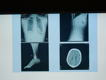 Agfa 인쇄 기계를 위해 방수 Konida 엑스레이 의학 화상 진찰 영화