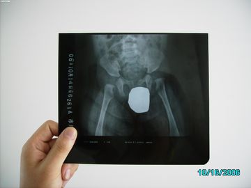Good price 은 할로겐 레이저 엑스레이 의학 화상 진찰 방수 얇은 Agfa DRYSTAR DT1B/DT2B 온라인으로