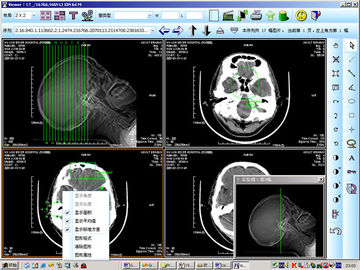 8 x 10inch KND-DRYTEC 4000를 위한 의학 종이 레이저 엑스레이 진단 화상 진찰