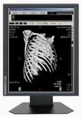 Good price 850cd/m2 Typ 광도 의학 급료는 20.1” 크기 G51SP를 표시합니다 온라인으로