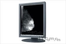 Good price 의학 급료 LCD 감시자 전시 온라인으로