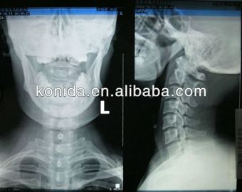 Good price 높은 날카로움 의학 진단 화상 진찰, 건조한 AGFA 엑스레이 영화 온라인으로