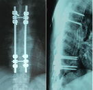 방수 의학 엑스레이 종이 애완 동물, Konida 레이저 프린터를 위한 영화, 방사선 사진 서류상 영화