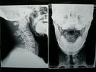 Fuji 3000/2000년/1000년을 위해 건조한 고밀도 의학 화상 진찰 영화 엑스레이