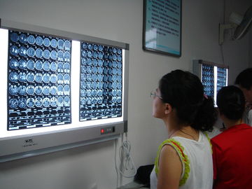 Fuji 인쇄 기계를 위한 건조한 레이저 의학 엑스레이 건조한 영화 10in x 12in