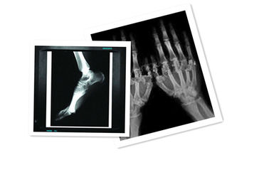 Hosipital 애완 동물 영화 의학 엑스레이 종이는 8 ×10 인치 CT 영화 백색을 방수 처리합니다