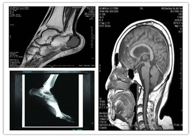 Good price 의학 디지털 방식으로 파란 기본적인 건조한 화상 진찰 영화 8 x 10in 호환성 Hosipital Mri 검사 온라인으로