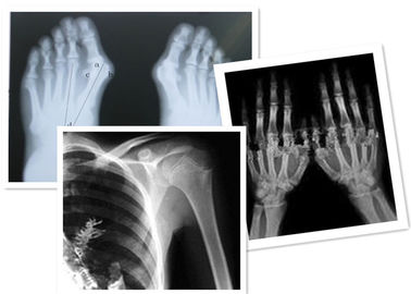 방사선 사진술 검사를 위해 의학 열 디지털 방식으로 엑스레이 영화 Fuji