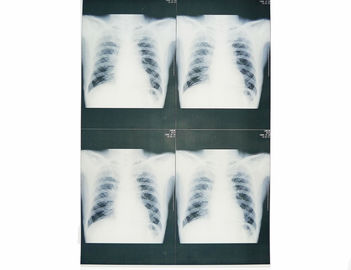 착용할 수 있는 백색 기본적인 의학 엑스레이 영화, 의학 화상 진찰 엑스레이 종이 영화