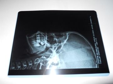 Konida 낮은 안개 엑스레이 검사를 위한 의학 건조한 화상 진찰 영화