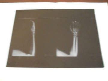 KND-A 낮은 안개 AGFA 5300 11in × 14in에 엑스레이 검사를 위한 의학 건조한 화상 진찰 영화